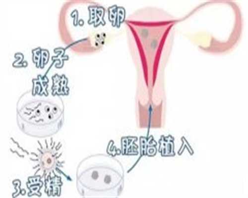 楚雄彝族自治州人民医院做一次供精人工授精费用多少？ 看这篇就够了